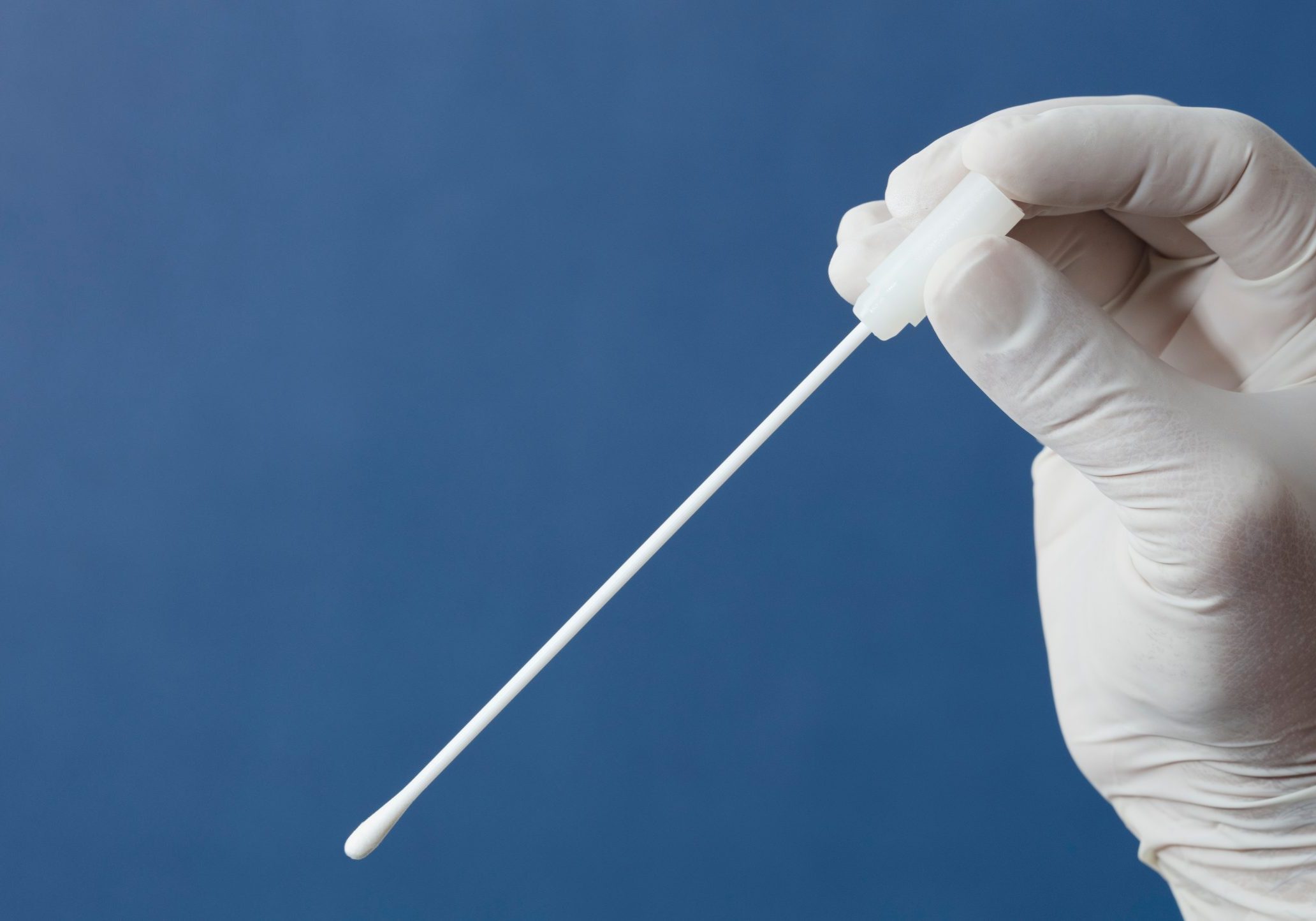 Pharynx,Swab,In,Doctor,Or,Nurse,Hands,With,Blue,Background One Simple Swab Method